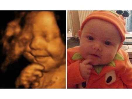 This Boy Was Smiling In The Womb This Boy Was Smiling In The Womb