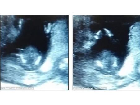 Baby With The Clapping Hands Baby With The Clapping Hands