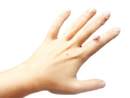 7. Treats Skin Conditions