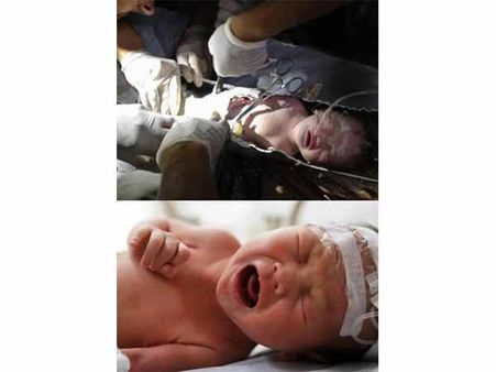 The Baby Who Was Stuck In A Toilet Pipe The Baby Who Was Stuck In A Toilet Pipe