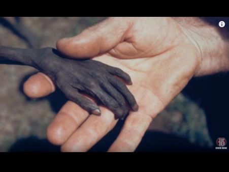 A Malnourished Hand A Malnourished Hand