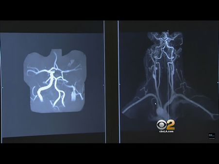 Reports Say... Reports Say...