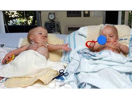 They Were Separated... They Were Separated...