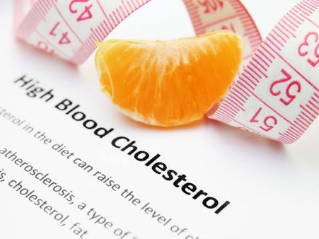 Cholesterol
