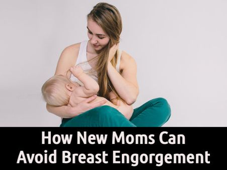 What Is Breast Engorgement?