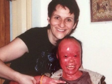 Her Condition Improved...