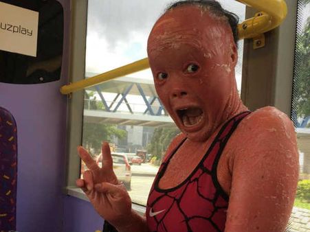 Her Skin Resembles That Of Fish Scales...