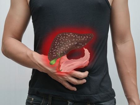 5. Causes Fatty Liver Disease: 5. Causes Fatty Liver Disease: