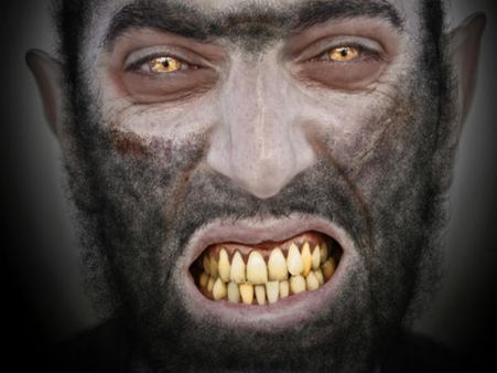 Werewolf Syndrome Werewolf Syndrome