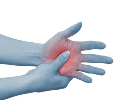 Argyria Or Blue-Skinned Disease Argyria Or Blue-Skinned Disease