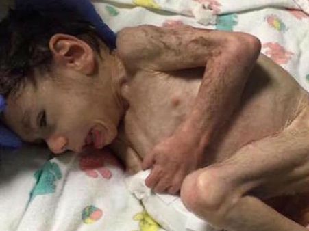 They Got The Boy To Tennessee