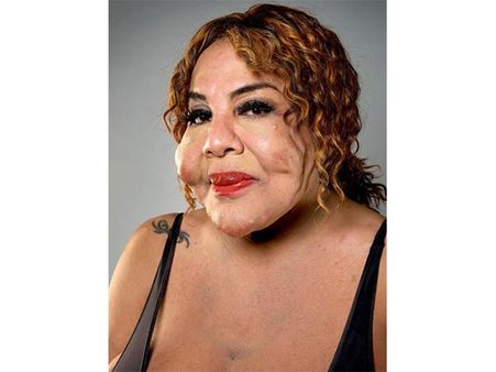 Current State Of Her?