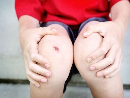 4. Treat Minor Wounds: 4. Treat Minor Wounds: