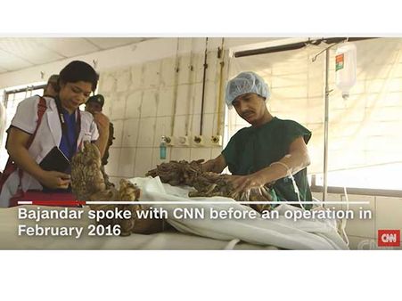 He Wishes To Lead A Normal Life