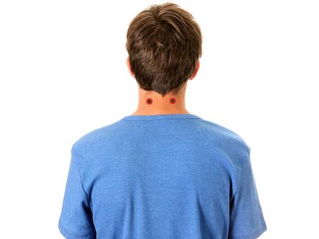 5. Base Of Skull: 5. Base Of Skull: