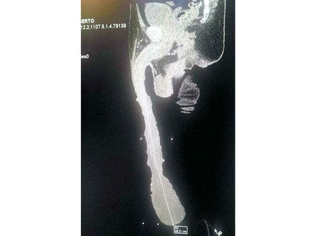 He Had X-Rayed It To Prove Its Veracity