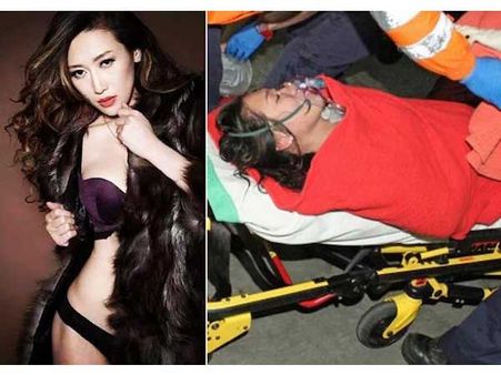 A Model Who Streamed Her Suicide Attempt