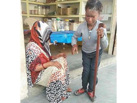 It Is Taking Her Life Bit By Bit...