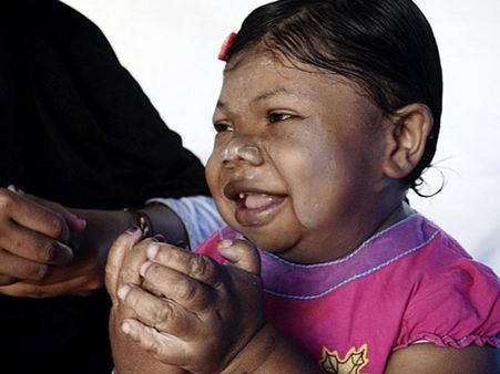 Her Condition Was Not Known Initially...