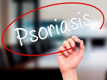 7. Psoriasis: