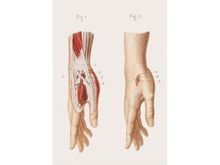 Correction Of Blood Supply...