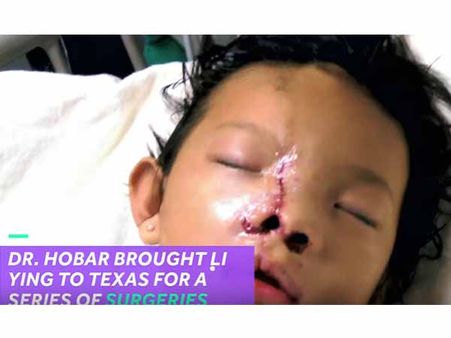 Her Surgeries Were Done In 10 Years Span… Her Surgeries Were Done In 10 Years Span…