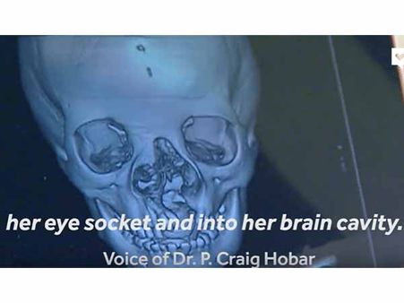 Her Condition Was Bad Her Condition Was Bad