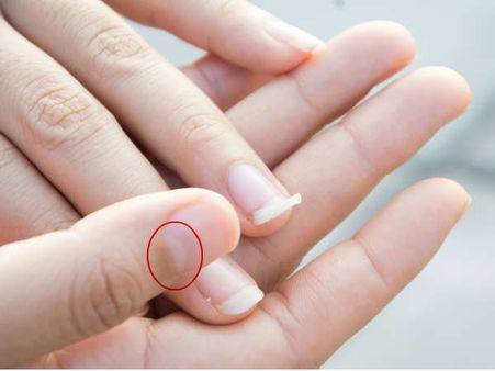 Half Moon On The Thumb