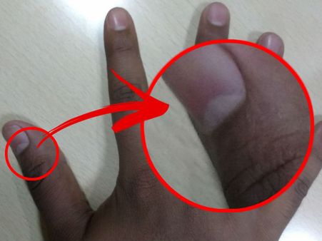 If You Do Not Have Any Half Moon On The Fingers, It Means…