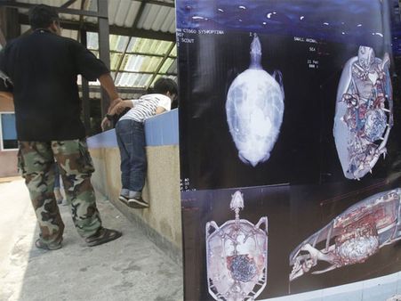 It Was A 7-hour Long Surgery…