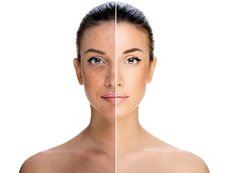 2. Promotes Healthy Skin