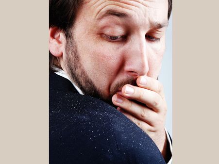 5. Treats Dandruff Problems