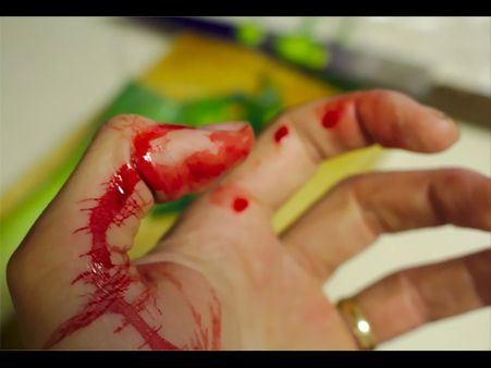 He Woke Up In Soaked Blood