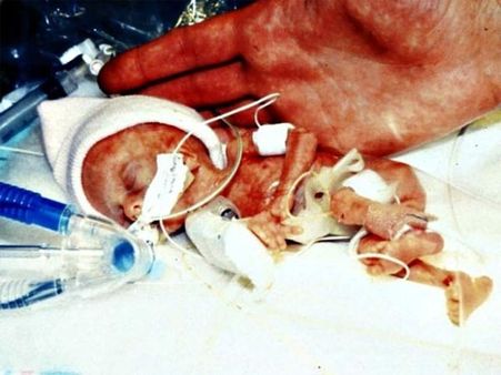 There Are Chances That All Babies Do Not Die In This Process… There Are Chances That All Babies Do Not Die In This Process…