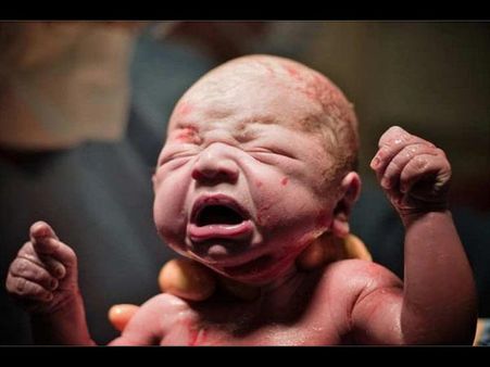 Currently, Saline Abortion Has Decreased Currently, Saline Abortion Has Decreased