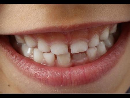 If The Gums Are Pink In Colour