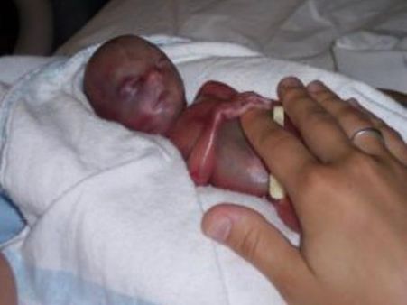 To Reduce Birth Pain… To Reduce Birth Pain…