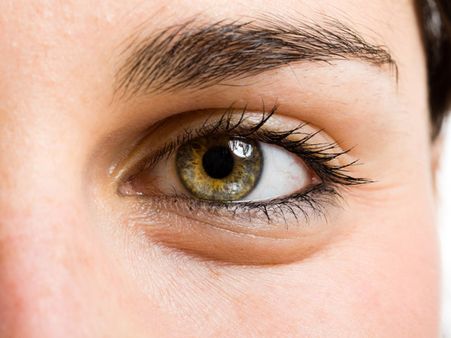 4. Treats Flaky Skin