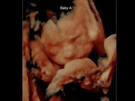 The Couple Were Confused With The Images