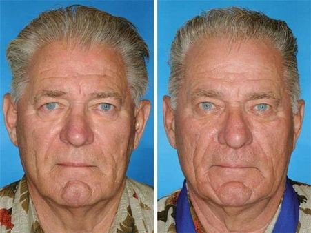 Don’t You Think It's Easy To Guess Which One's The Smoker Here?