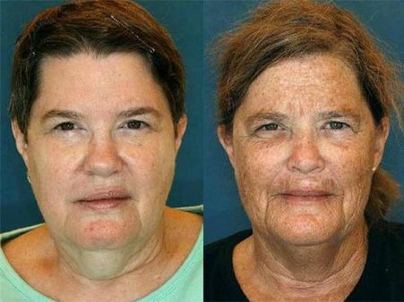 Don’t You Think The Difference Is Gruesome?