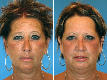 Wish To Even Guess The Smoker?