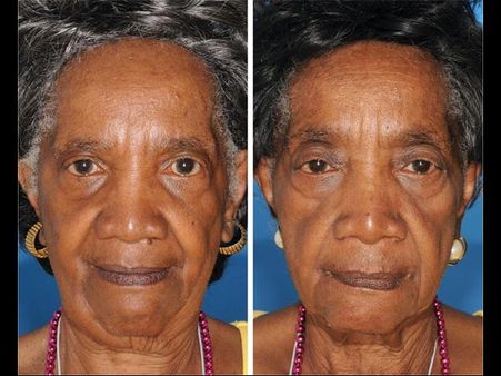 Whao! The Difference Is So Clear!