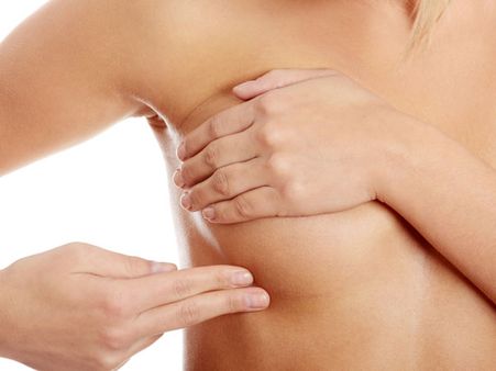 18. Nipple Changes: