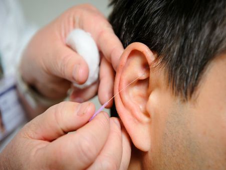 6. Rinsing The Ear With A Syringe 