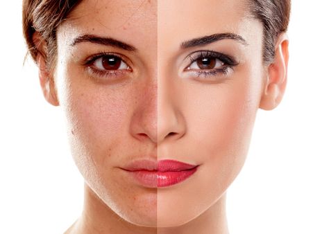 2. Lightens The Blemishes 2. Lightens The Blemishes