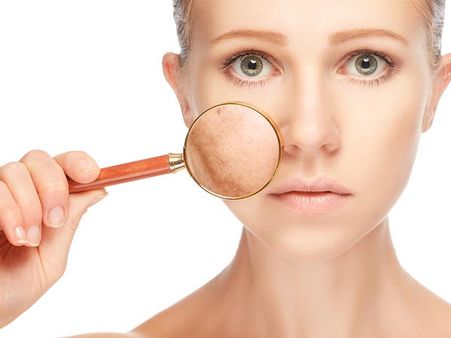 6. To Treat Dark Spots On The Skin