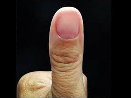 The Thumb Factor…