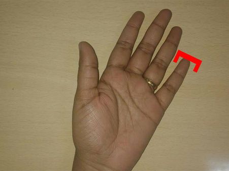 If The Little Finger Is SQUARE!