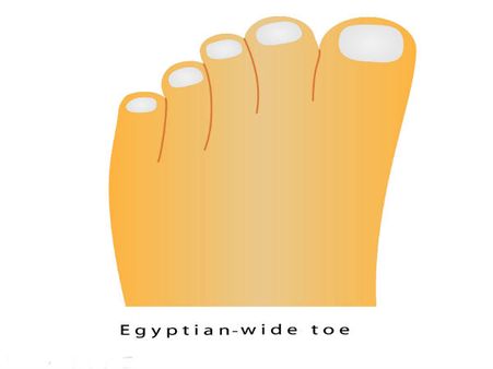 The Narrow Base Of Second Toe!